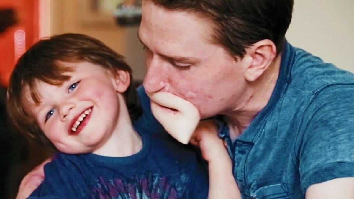 L'incredibile storia di papà Alex Lewis, sopravvissuto al virus killer 13