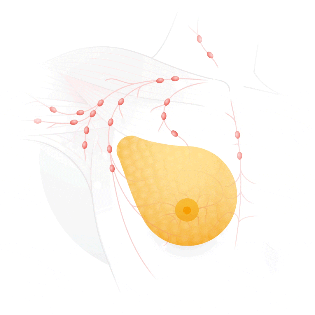 Cancro al seno: l'Intelligenza Artificiale ti dirà se sei a rischio 4 Cancro al seno: l'Intelligenza Artificiale ti dirà se sei a rischio 3