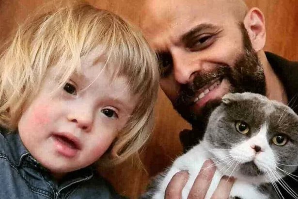 "La sua non è una malattia ma un modo di essere”: papà single adotta Alba, bimba down che nessuno voleva 11