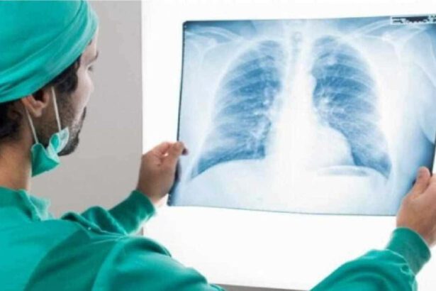 Covid, studio italiano scopre perché si muore nelle terapie intensive 10