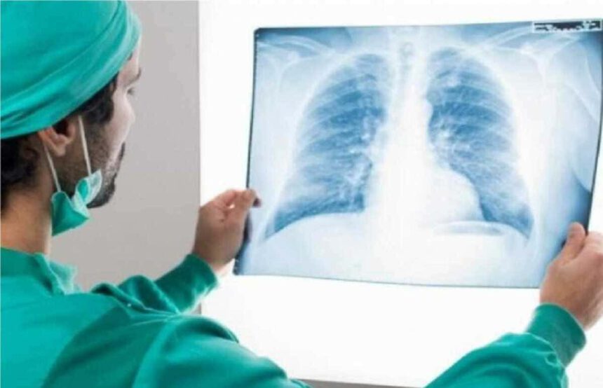 Covid, studio italiano scopre perché si muore nelle terapie intensive 1