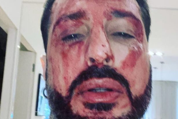 Fabrizio Corona torna in carcere: si taglia i polsi, poi si ribella agli agenti rompendo il finestrino 18