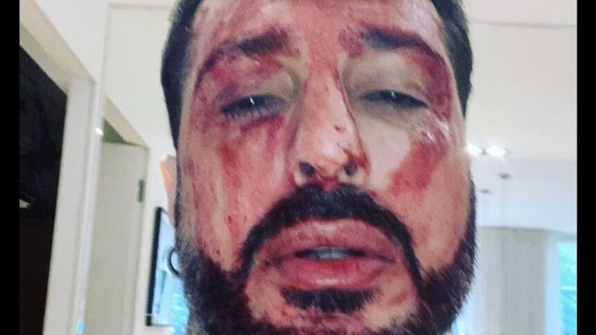 Fabrizio Corona torna in carcere: si taglia i polsi, poi si ribella agli agenti rompendo il finestrino 1