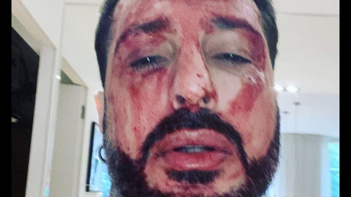 Fabrizio Corona torna in carcere: si taglia i polsi, poi si ribella agli agenti rompendo il finestrino 15