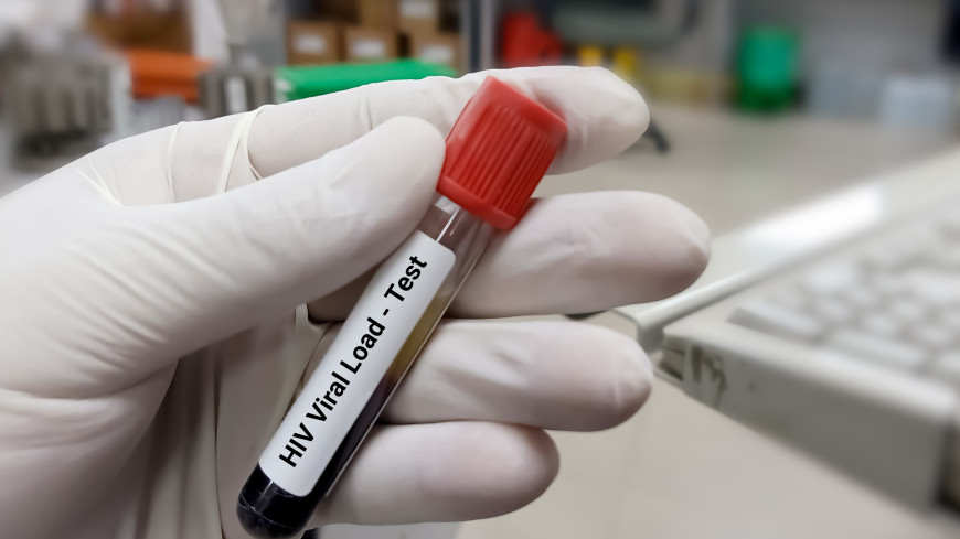 Donna guarita dall'HIV: il nuovo metodo