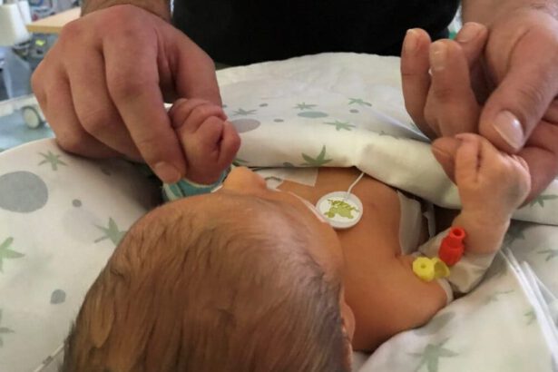 Chloe nata il 31 dicembre e operata il 1 gennaio, la storia di una rinascita 15