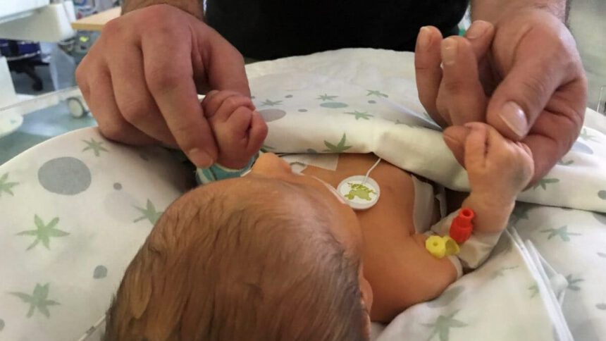 Chloe nata il 31 dicembre e operata il 1 gennaio, la storia di una rinascita 2 Chloe nata il 31 dicembre e operata il 1 gennaio, la storia di una rinascita 1