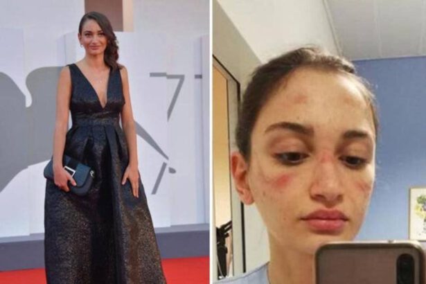 Alessia Bonari a Venezia 77: l'infermiera simbolo della lotta al Covid sul Red Carpet 9