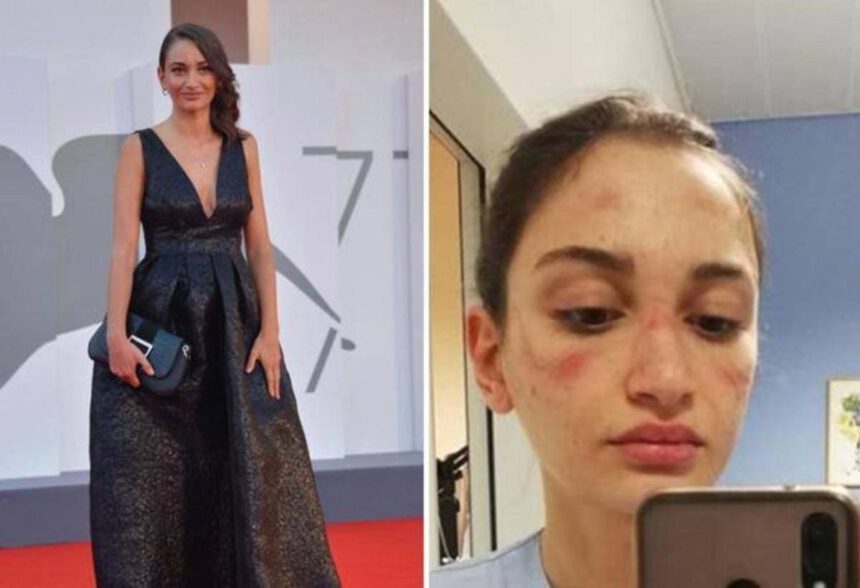 Alessia Bonari a Venezia 77: l'infermiera simbolo della lotta al Covid sul Red Carpet 1