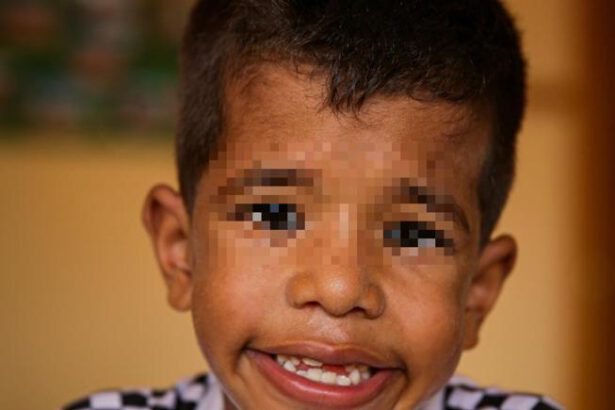 Bimbo cieco vede per la prima volta: "Ora posso guardare il viso dei miei genitori" 13