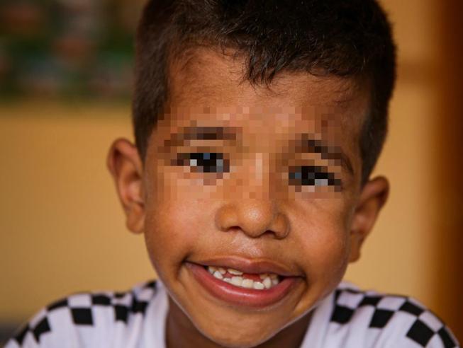 Bimbo cieco vede per la prima volta: "Ora posso guardare il viso dei miei genitori" 1