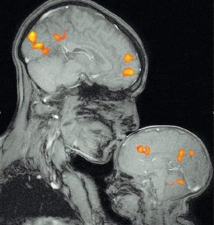Il mal di testa passa con un bacio, la risoza lo conferma 4 Il mal di testa passa con un bacio, la risoza lo conferma 3