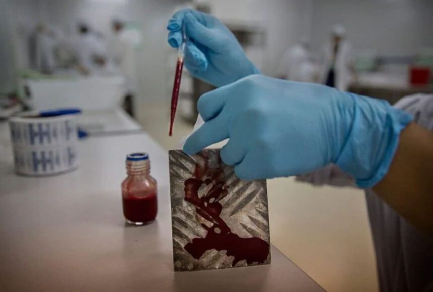 Batterio Cina, in 3mila infettati dalla brucellosi per una fuga di laboratorio 1