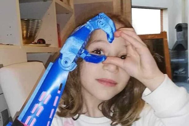 La storia di Greta e della sua nuova manina grazie a EFP: "Doniamo dispositivi low cost a decine di bambini" 13