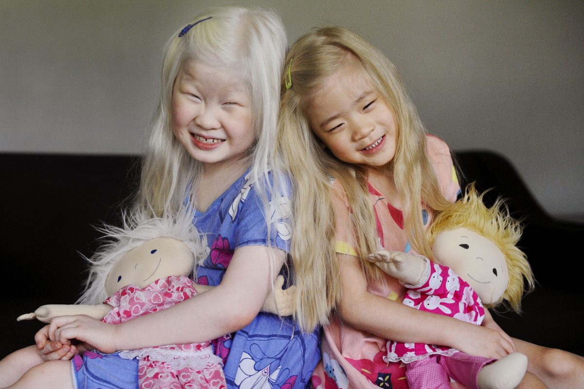 "A doll like me": le bambole che aiutano i bambini malati ad accettare le diversità 17