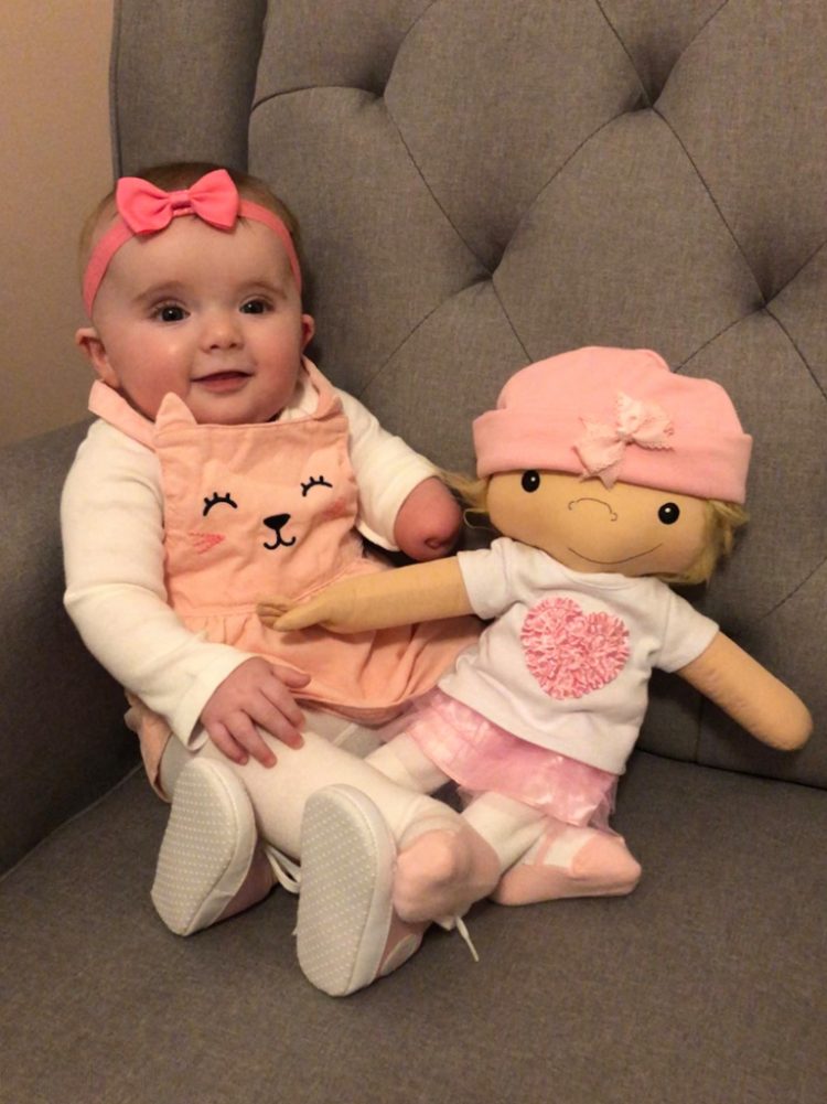 "A doll like me": le bambole che aiutano i bambini malati ad accettare le diversità 3