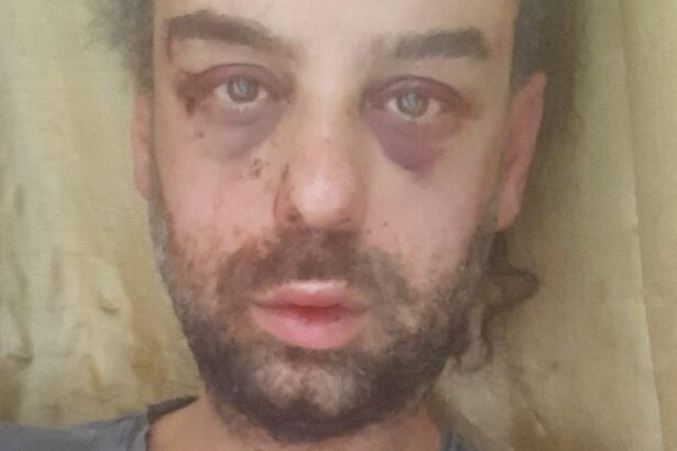 Attivista Lgbt picchiato a Trieste, il consigliere leghista: "Ha litigato con il fidanzato per la vaselina" 18