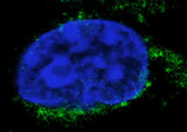 Staminali "super efficienti" contro il virus, la scoperta dell'ultimo studio italiano 3 La scoperta delle staminali contro i virus: i risultati della ricerca.