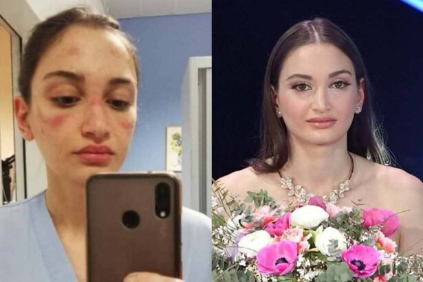 Sanremo, Alessia Bonari: “Donerò il mio compenso per cure palliative ai malati” 7