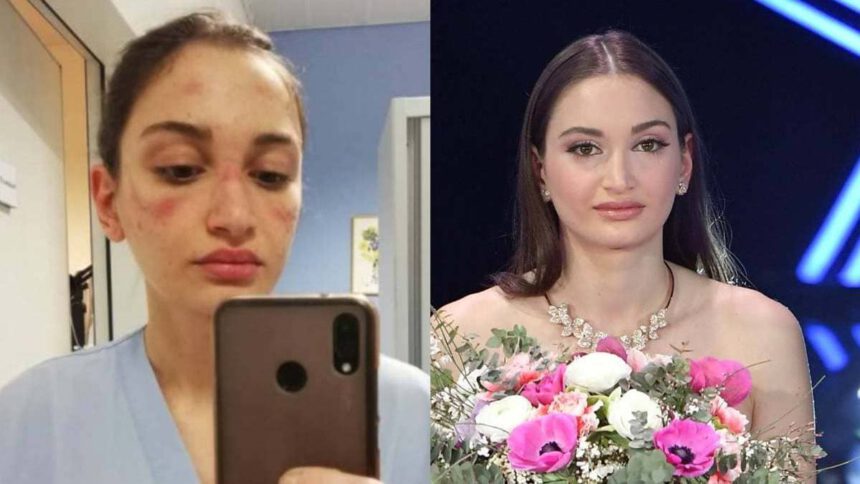 Sanremo, Alessia Bonari: “Donerò il mio compenso per cure palliative ai malati” 1