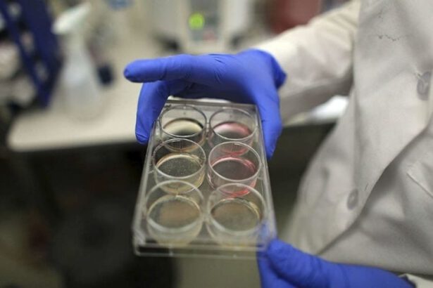 La lattoferrina salva dal Covid? La parola degli esperti 18