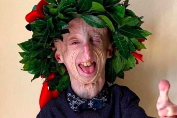 Discute la tesi sulla sua malattia: congratulazioni a Sammy Basso, oggi dottore in Molecular Biology 14