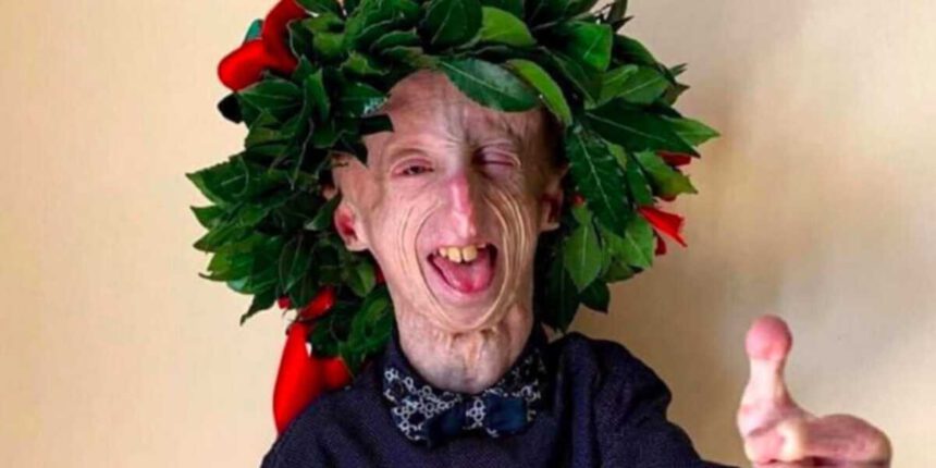 Discute la tesi sulla sua malattia: congratulazioni a Sammy Basso, oggi dottore in Molecular Biology 1