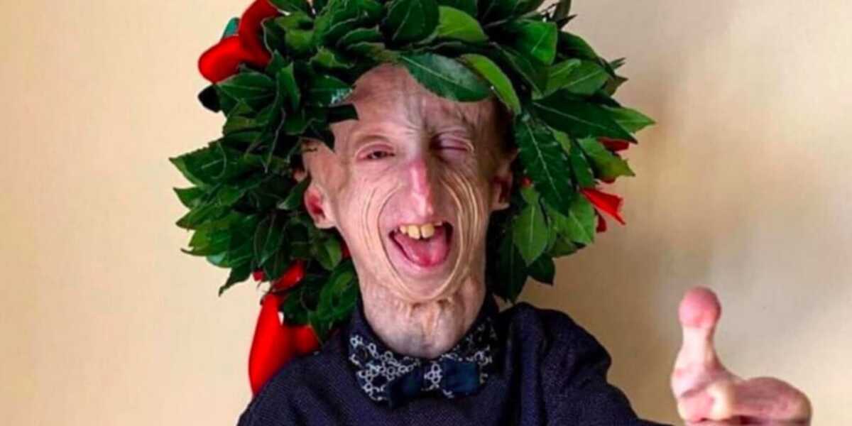 Discute la tesi sulla sua malattia: congratulazioni a Sammy Basso, oggi dottore in Molecular Biology 15