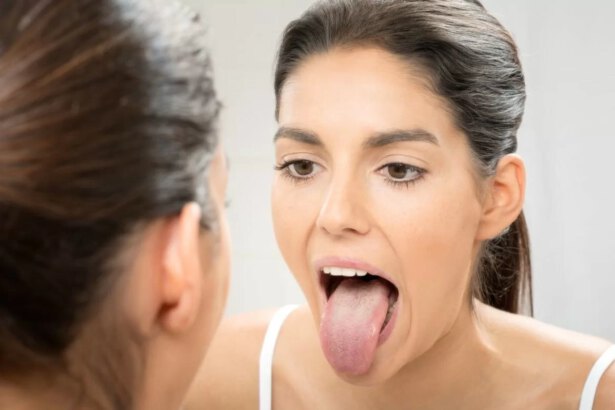 Lingua bianchissima, da	cosa	dipende? 10