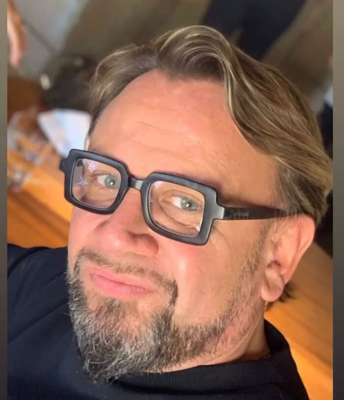 Chirurgia plastica e medicina estetica in Italia dopo il lockdown: incremento di filler per ringiovanire 3 Chirurgia plastica e medicina estetica dopo il lockdown in Italia: la statistica di Clinic Medical Beauty