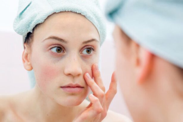 Le occhiaie compaiono sempre più spesso? Ecco perché e i rimedi per eliminarle 15