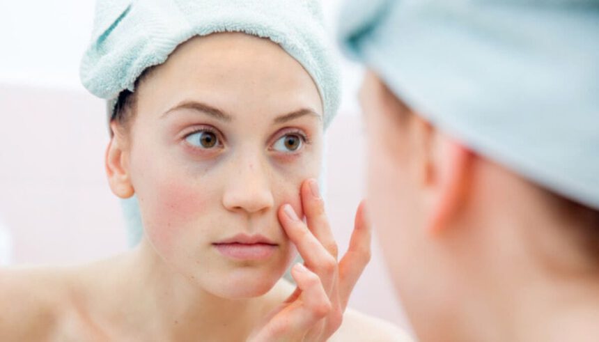 Le occhiaie compaiono sempre più spesso? Ecco perché e i rimedi per eliminarle 1