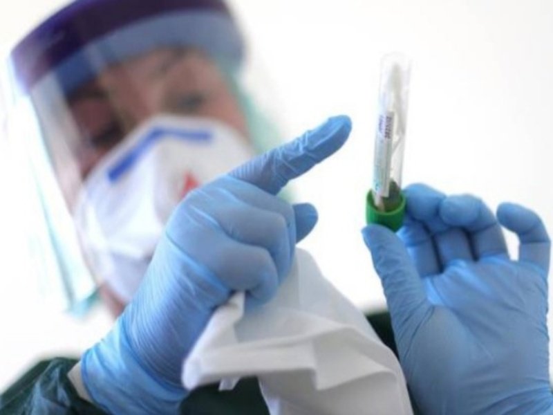 Coronavirus, dall'Olanda il farmaco per sconfiggerlo 1