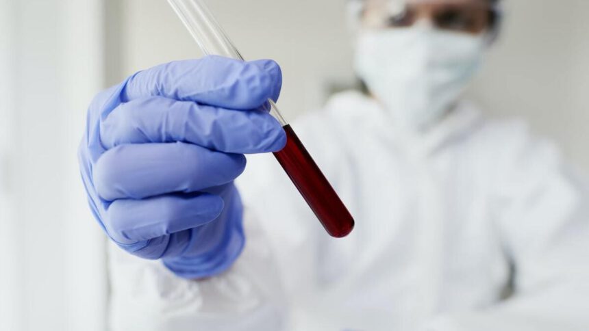 Scoperta a Tor Vergata: il plasminogeno possibile chiave per capire il Covid 1