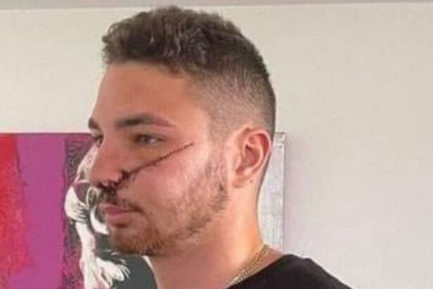 Rider sfregiato al volto per aver difeso una ragazza in difficoltà: “Lo rifarei ancora” 9