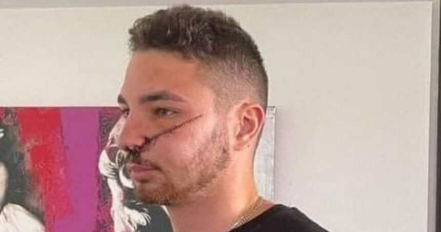 Rider sfregiato al volto per aver difeso una ragazza in difficoltà: “Lo rifarei ancora” 1