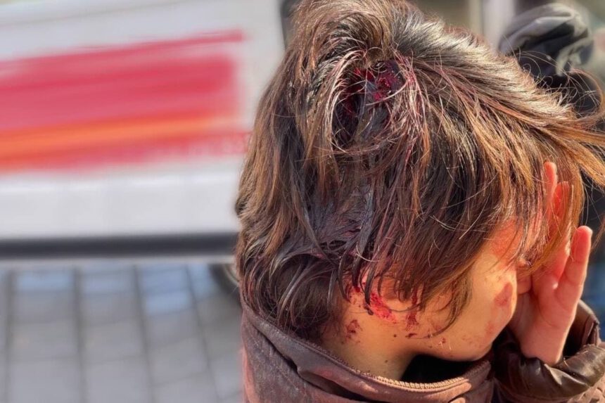 Violenze sugli studenti, Sara: "Manganellate anche dopo che mi avevano aperto la testa" 1