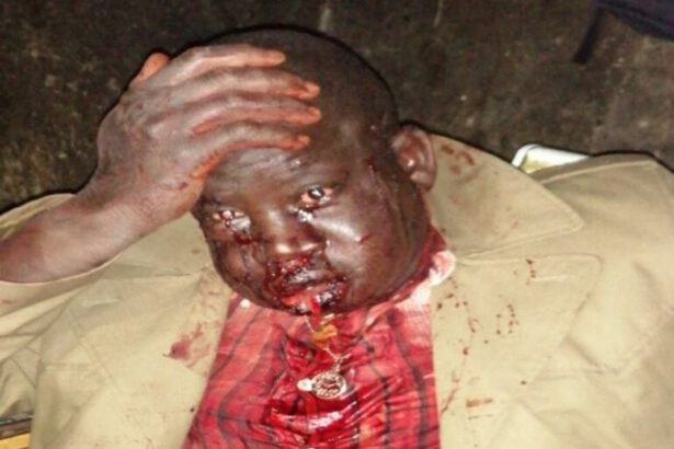 Agguato a Foggia, spari contro tre migranti: uno di loro è gravemente ferito al volto 14