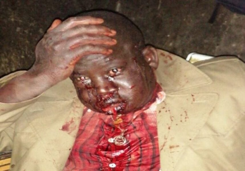 Agguato a Foggia, spari contro tre migranti: uno di loro è gravemente ferito al volto 1