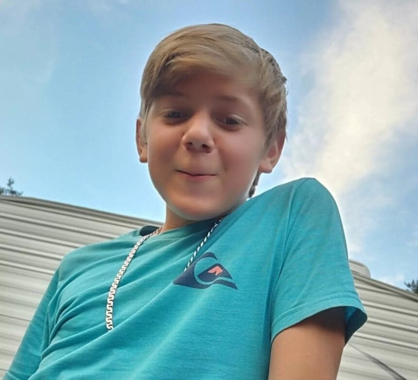 Ameba mangia cervello uccide un bambino in Florida. Qual è la situazione in Italia? 1