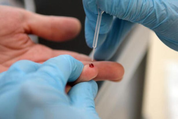 Dal 18 maggio al via i test sierologici a chiamata per anticorpi Covid 7