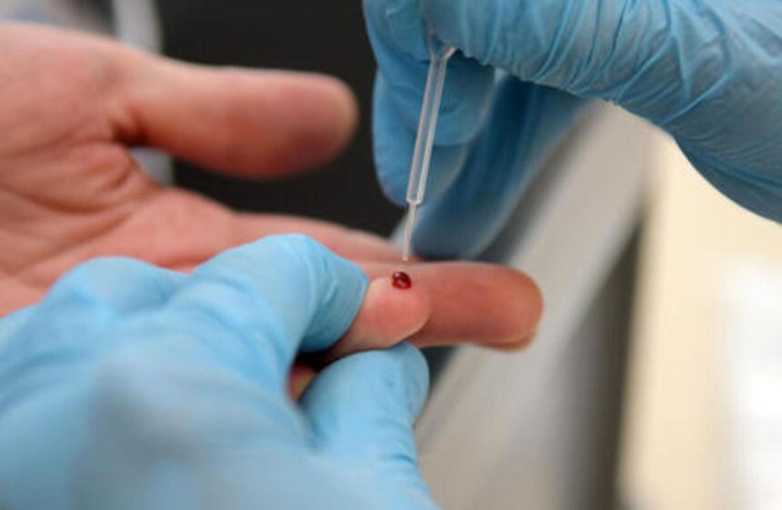 Dal 18 maggio al via i test sierologici a chiamata per anticorpi Covid 1