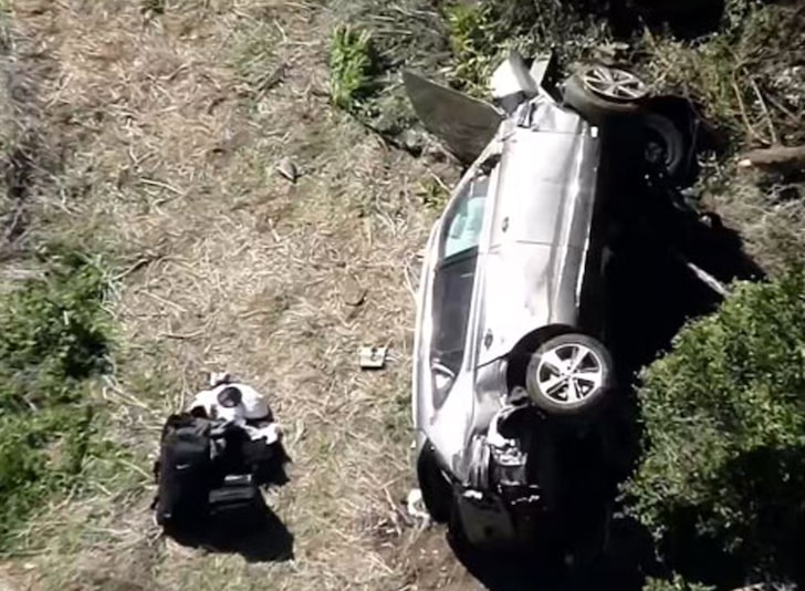 Tiger Woods operato alle gambe per un incidente d'auto 1
