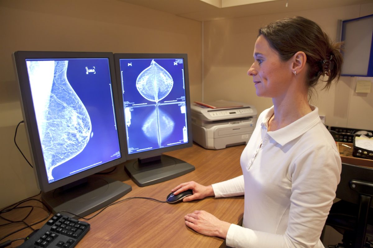 Cancro al seno: l'Intelligenza Artificiale ti dirà se sei a rischio 15