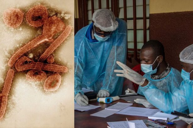 Oms conferma nuova infezione da virus Marburg: primo morto in Guinea 18