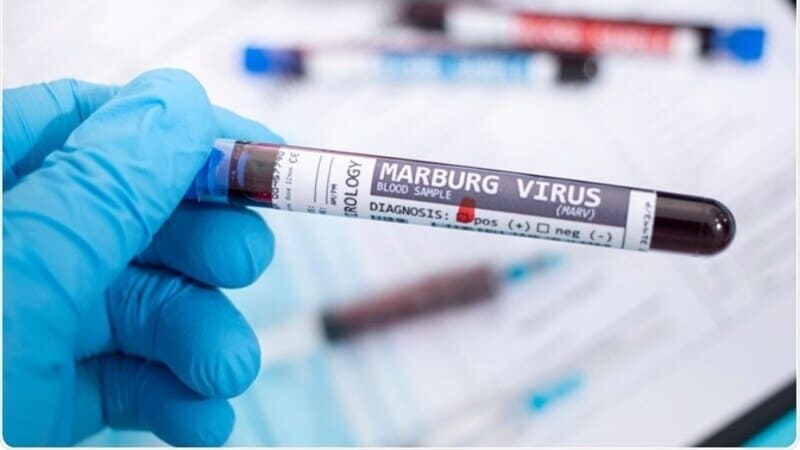 virus Marburg_guinea