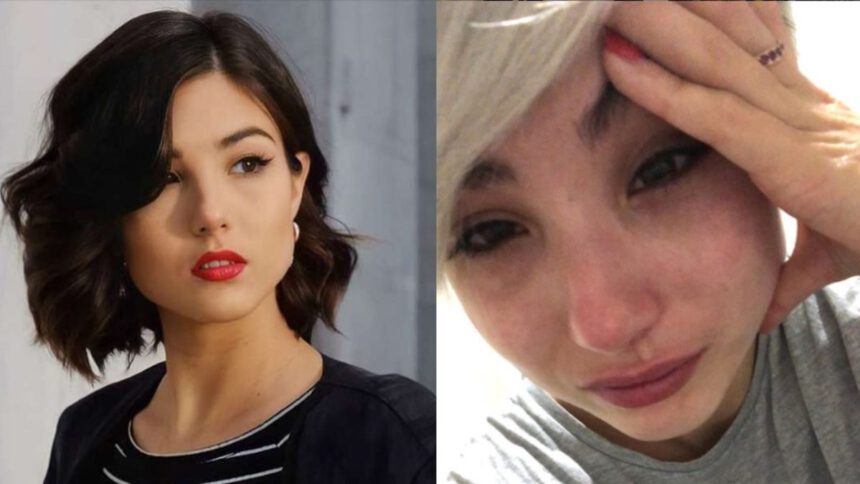 Cos’è la vulvodinia, malattia di cui soffre la fidanzata di Damiano dei Maneskin 1