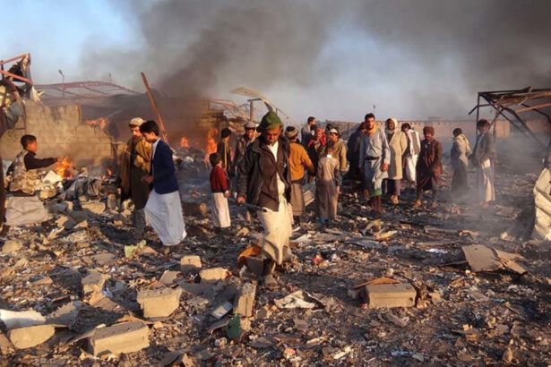 Yemen, coalizione saudita blocca le risorse primarie: 400mila bambini a rischio per mancanza di cure 5