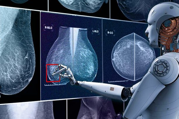 Tumore al seno: l'IA è in grado di diagnosticarlo precocemente 7