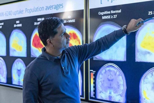 Alzheimer, ci sarà il vaccino? E come agisce? 14